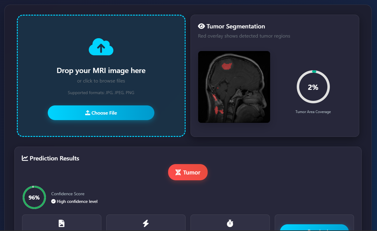 BRAIN TUMOR AI DETECTOR